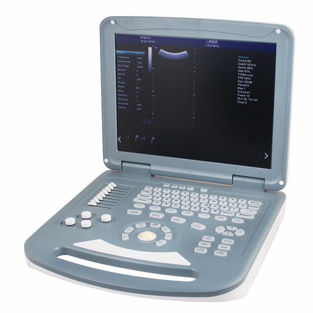 15" Digital Color Doppler Ultrasound Scanner Diagnostic Convex Linear Probe A+ 190891276681 DIAGNOSTIC ULTRASOUND MACHINES FOR SALE