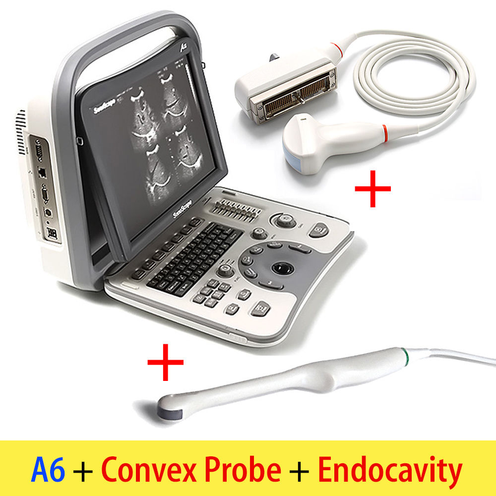 Portable SonoScape A6 Ultrasound Machine Scanner System - Transvaginal & Convex DIAGNOSTIC ULTRASOUND MACHINES FOR SALE