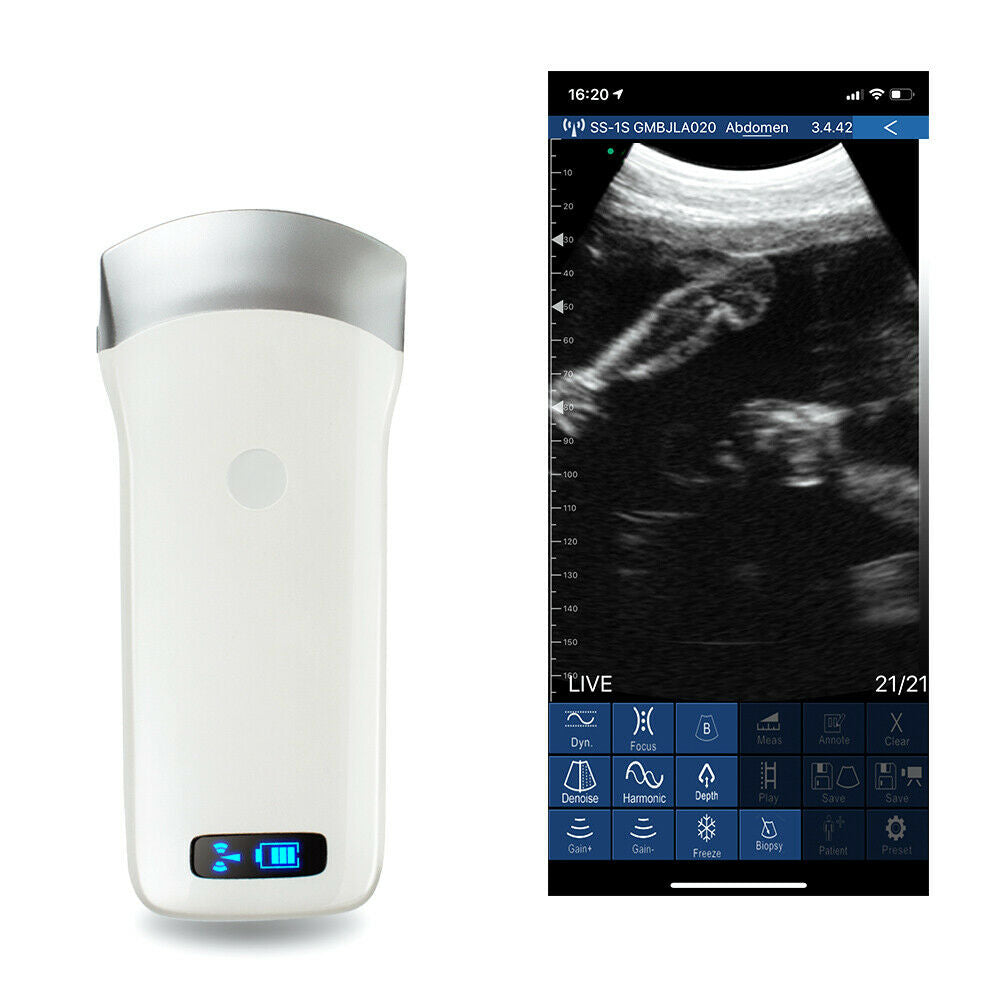 Ultrasound scanner Convex Probe Wifi IOS Android Electronic array 3.5Mhz Digital DIAGNOSTIC ULTRASOUND MACHINES FOR SALE