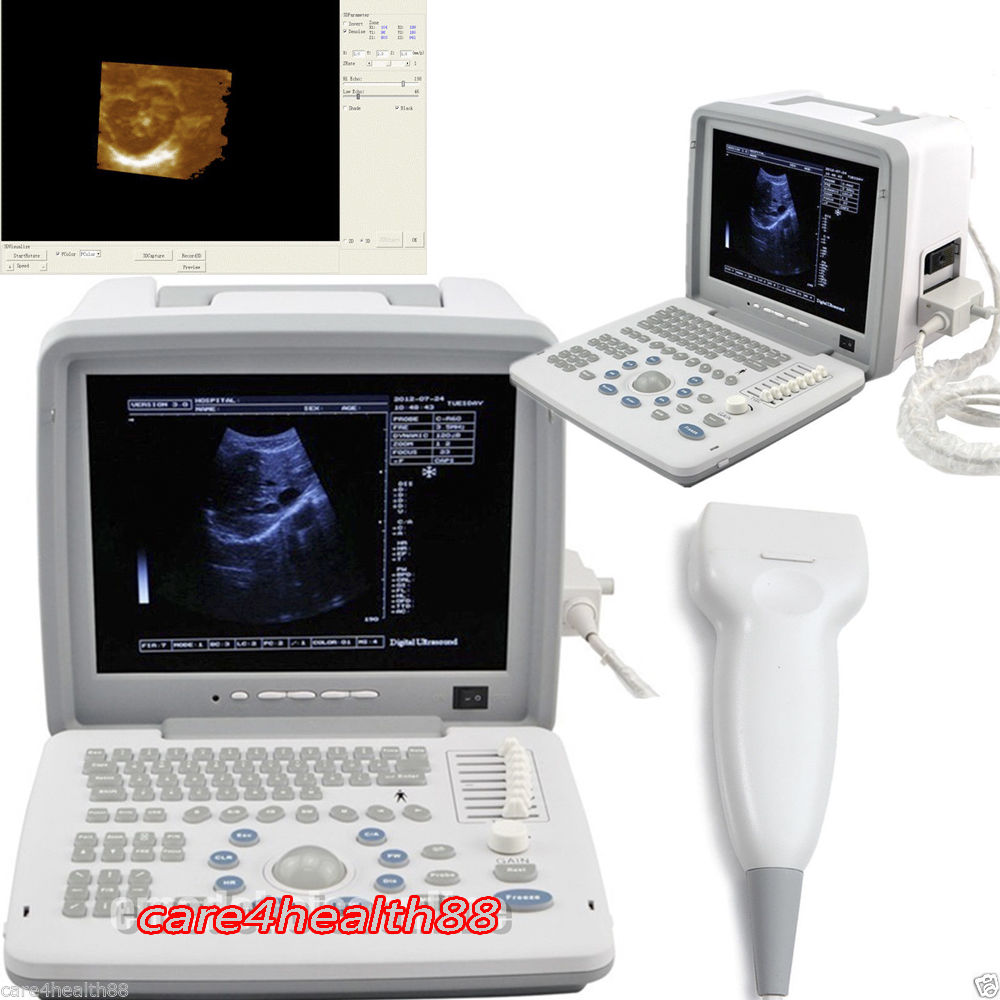 Portable Digital Ultrasound Machine Scanner System 7.5 Mhz Linear Probe Free 3D DIAGNOSTIC ULTRASOUND MACHINES FOR SALE