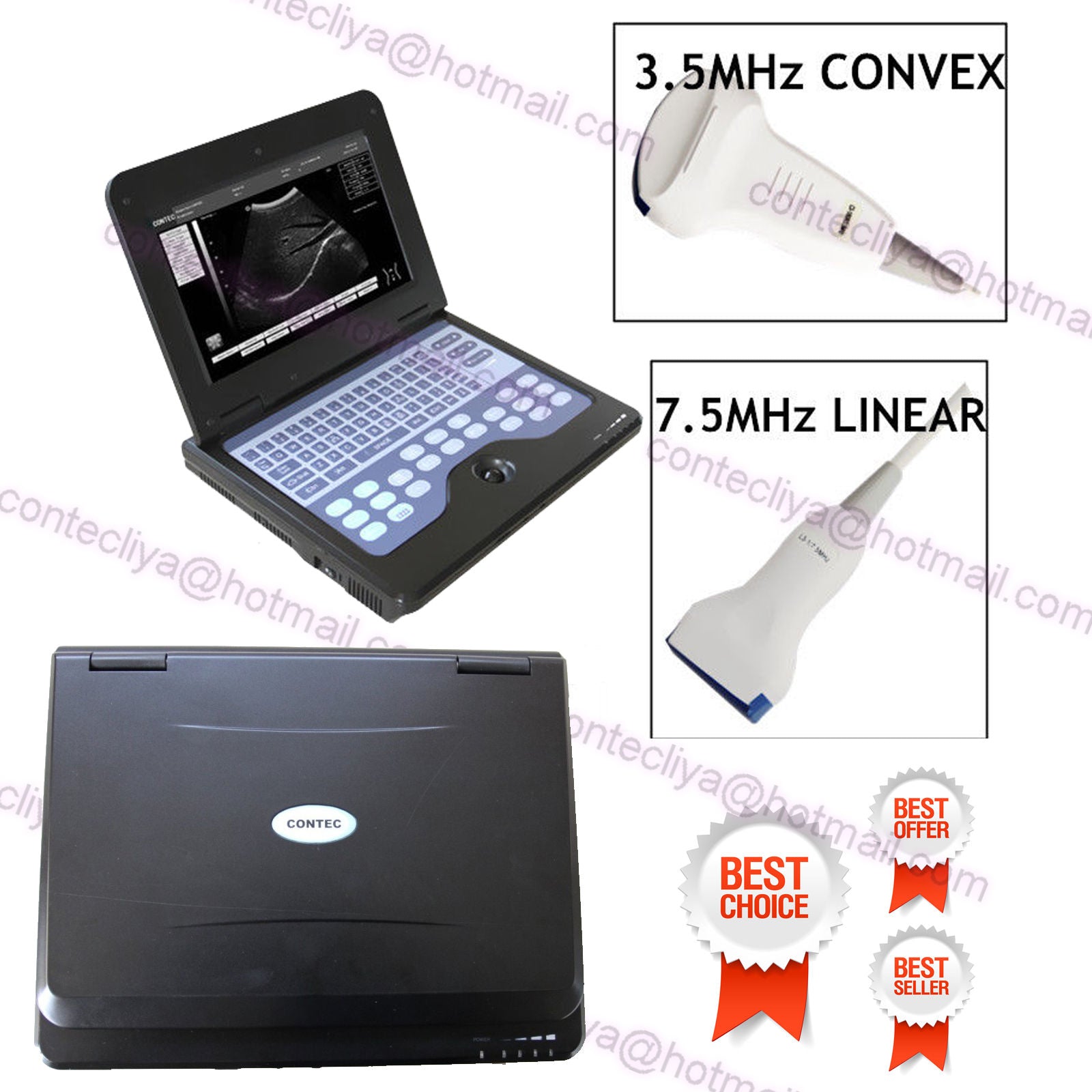 CE Digital Ultrasound Scanner Laptop Machine Diagnostic System Optional 4 Probe DIAGNOSTIC ULTRASOUND MACHINES FOR SALE