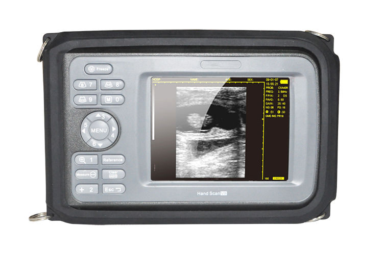 Vet Digital Portable Ultrasound Ultrasonic Scanner Machine Animal + Rectal Probe DIAGNOSTIC ULTRASOUND MACHINES FOR SALE