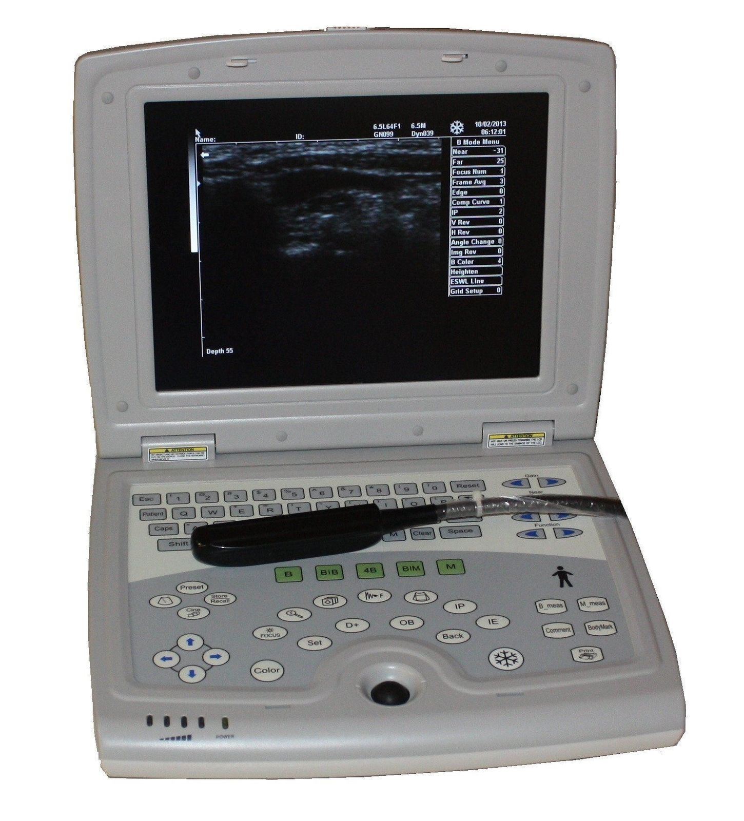 KX-5000V on Sale DIAGNOSTIC ULTRASOUND MACHINES FOR SALE