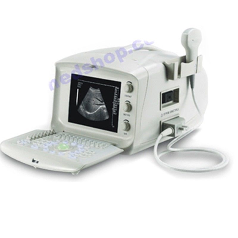 Portable Ultrasound Scanner machine system + 3.5 Mhz convex probe +3D Better 190891613028 DIAGNOSTIC ULTRASOUND MACHINES FOR SALE