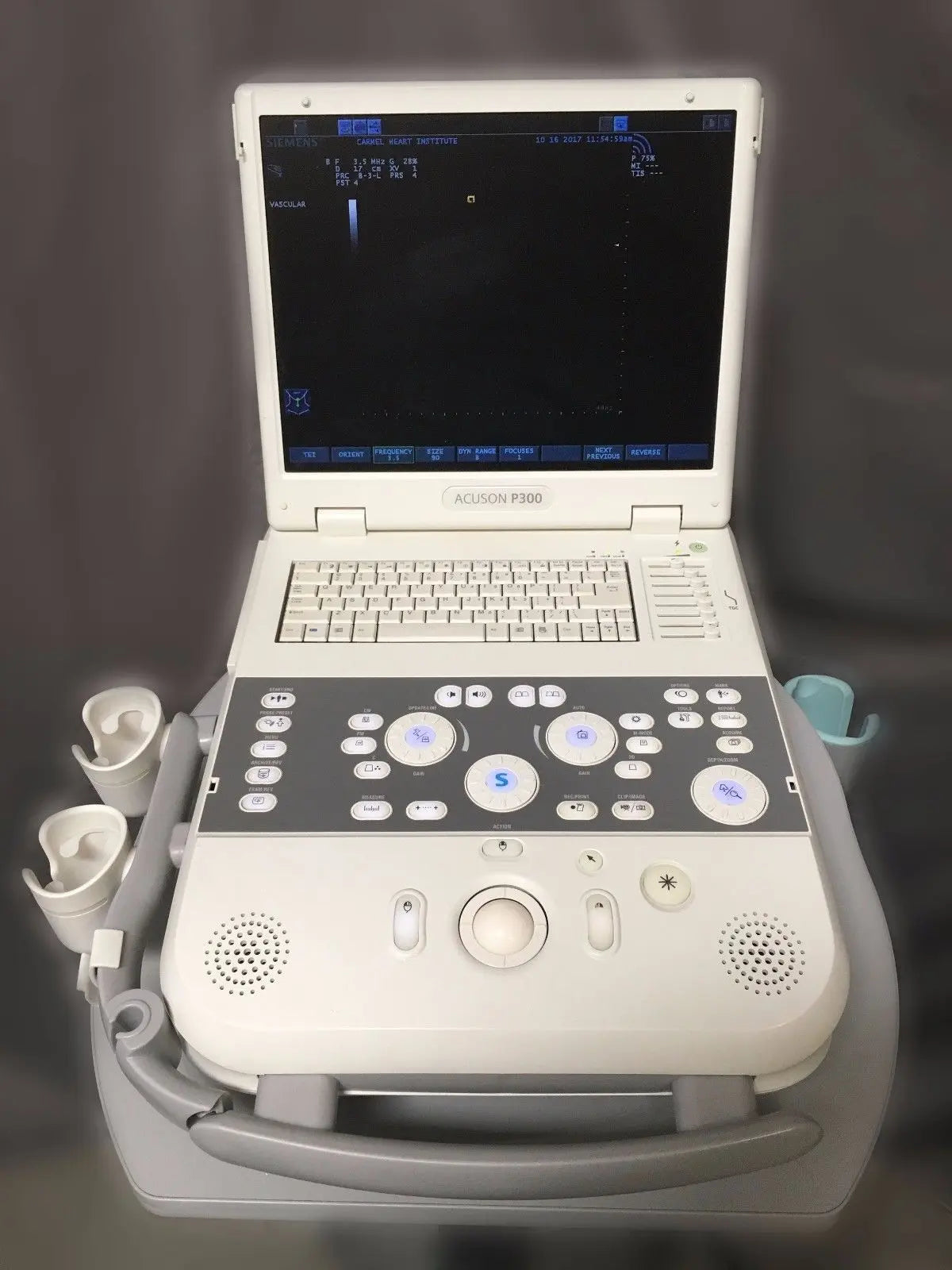 Siemens Acuson P300 Portable Ultrasound DIAGNOSTIC ULTRASOUND MACHINES FOR SALE