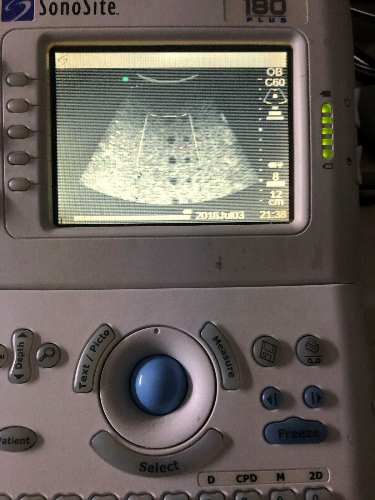 SonoSite 180 Plus Portable Ultrasound System With C60/5-2 Probe DIAGNOSTIC ULTRASOUND MACHINES FOR SALE