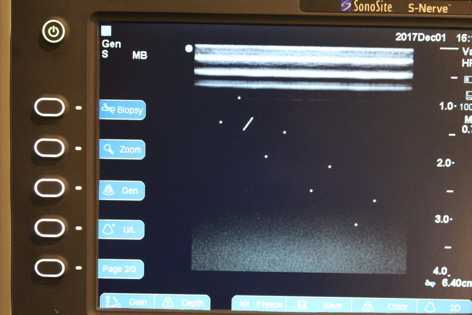 Sonosite S-Nerve vascular/nerve ultrasound with HFL38x-13-6 MHz transducer DIAGNOSTIC ULTRASOUND MACHINES FOR SALE