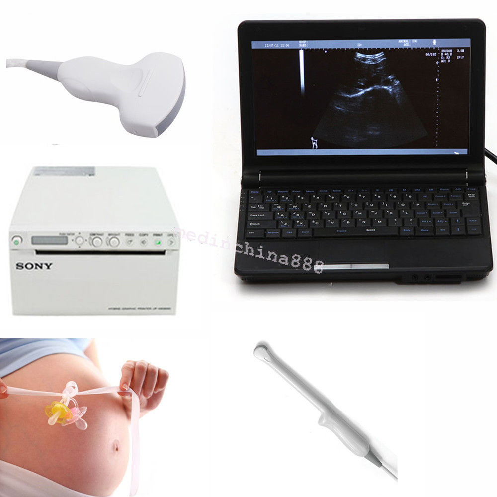 Ultrasound Scanner Equip Convex N Trans-vaginal Probe N Recorder/Printer Sale DIAGNOSTIC ULTRASOUND MACHINES FOR SALE