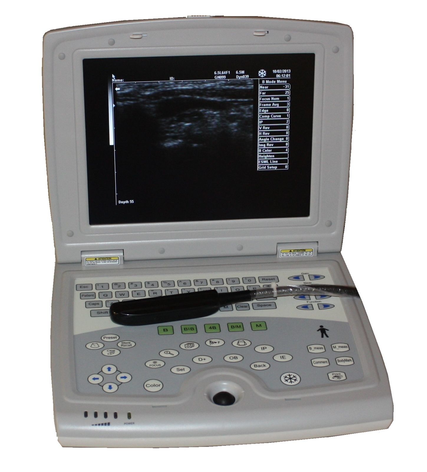 KX5000V Veterinary Laptop Ultrasound, Large Animal, Bovine, Horse | KeeboMed DIAGNOSTIC ULTRASOUND MACHINES FOR SALE