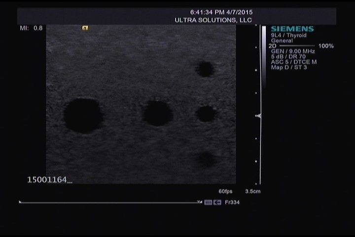 Siemens ACUSON 9L4 Ultrasound Transducer DIAGNOSTIC ULTRASOUND MACHINES FOR SALE