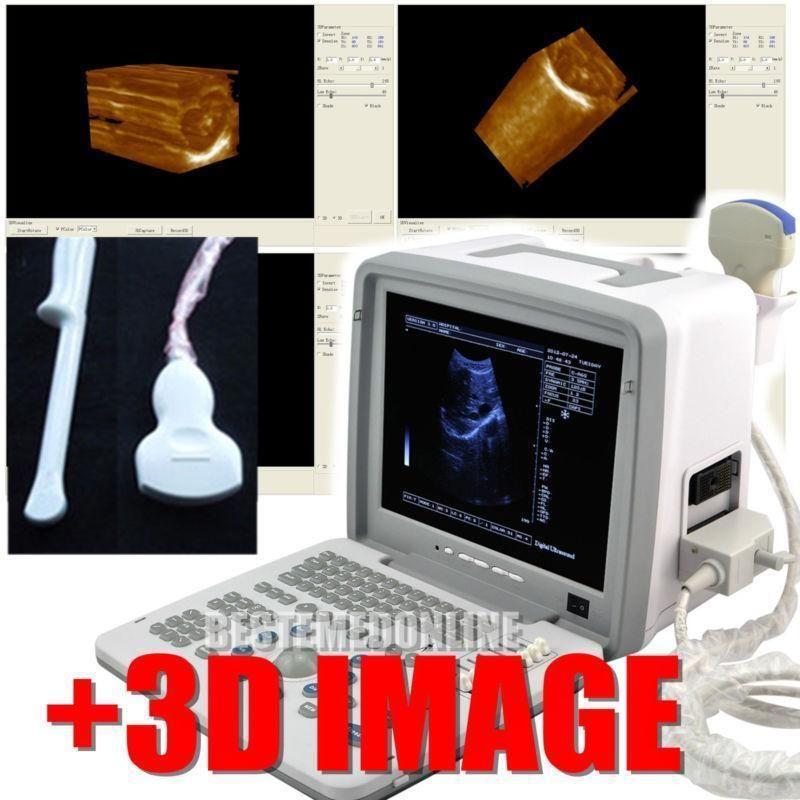 Digital Ultrasound Scanner Convex Transvaginal Probe +3D Ultrasound Equipment 190891416810 DIAGNOSTIC ULTRASOUND MACHINES FOR SALE