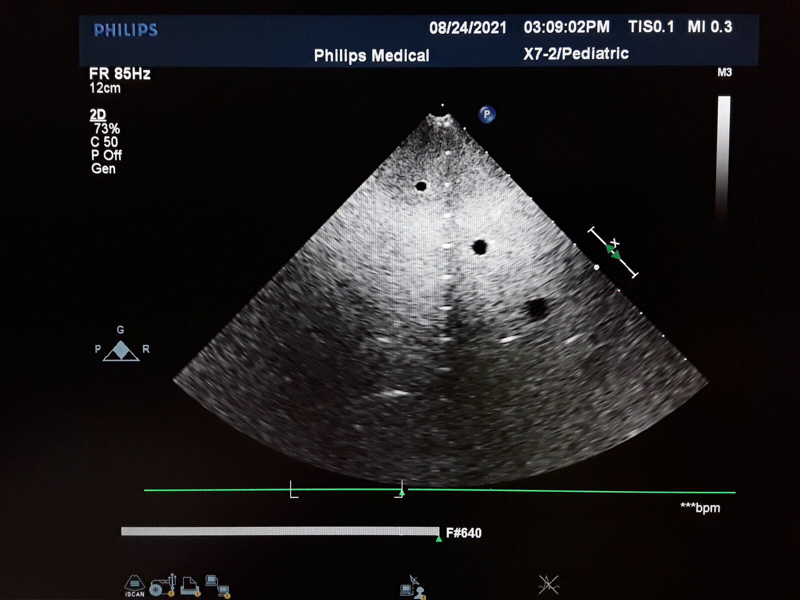 Philips Healthcare X7-2 Ultrasound Probe DIAGNOSTIC ULTRASOUND MACHINES FOR SALE