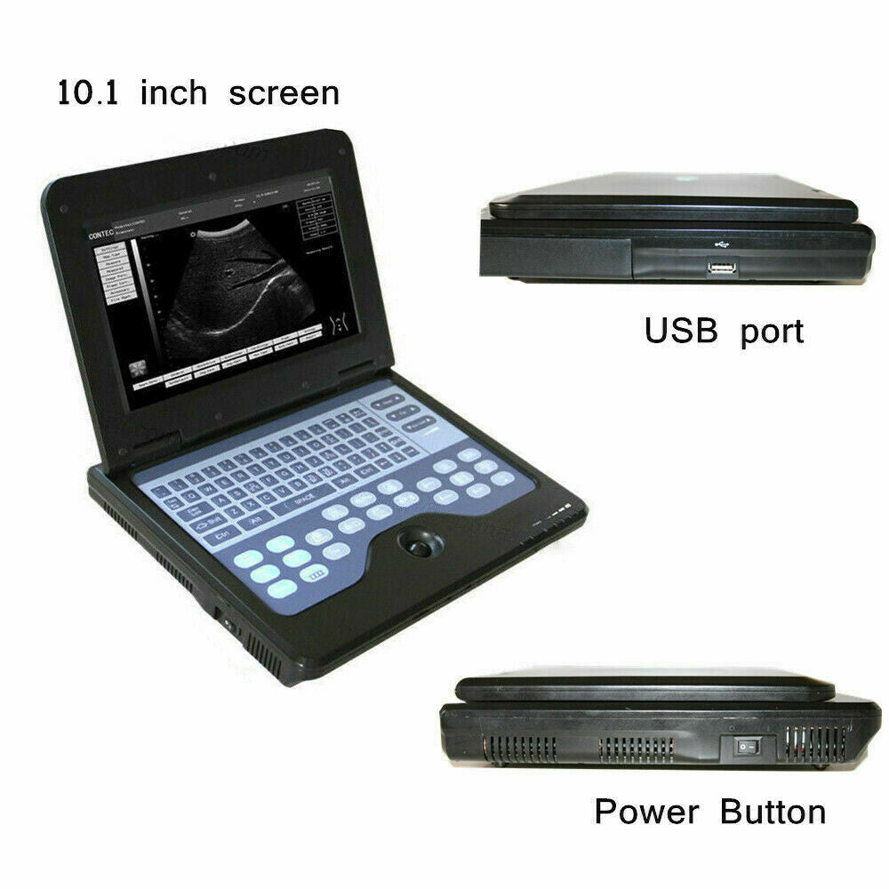 Digital Portable Ultrasound Machine Laptop Scanner with 3.5Mhz Convex Probe CE  6945040100362 DIAGNOSTIC ULTRASOUND MACHINES FOR SALE