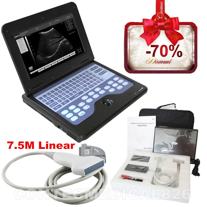 CE Portable Ultrasound Scanner Laptop Machine Diagnostic System Optional 4 Probe DIAGNOSTIC ULTRASOUND MACHINES FOR SALE