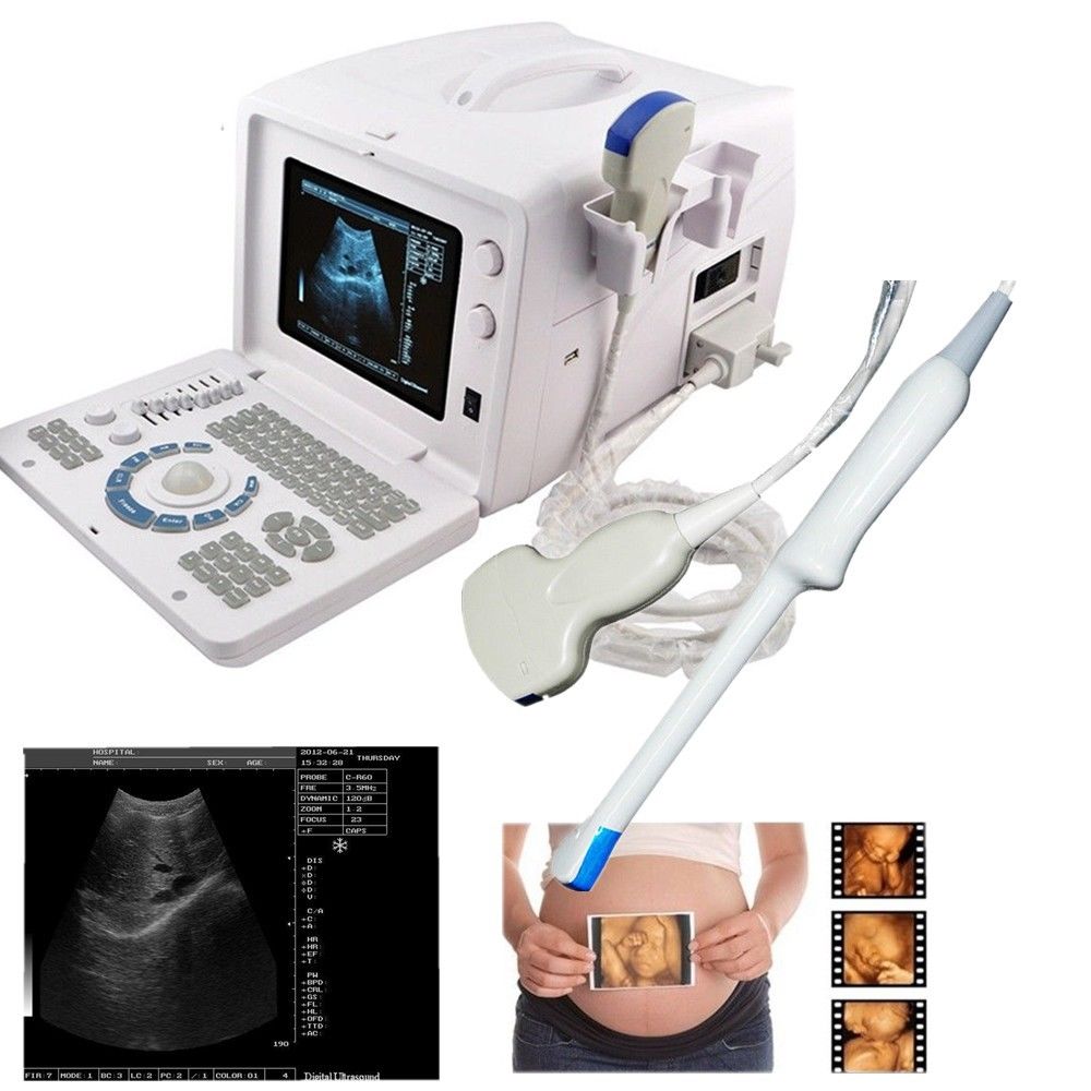 Hot 3D Digital Portable Ultrasound Scanner Machine Convex +Transvaginal 2 Probe 190891747990 DIAGNOSTIC ULTRASOUND MACHINES FOR SALE