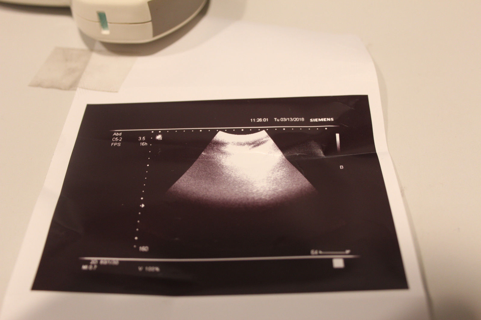 Siemens C5-2 Convex Ultrasound Transducer OB-GYN Urology & Abdominal DIAGNOSTIC ULTRASOUND MACHINES FOR SALE