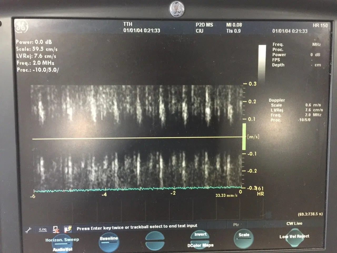 GE P2D 2D Non-Imaging Pencil CW Doppler Ultrasound Transducer Probe DIAGNOSTIC ULTRASOUND MACHINES FOR SALE