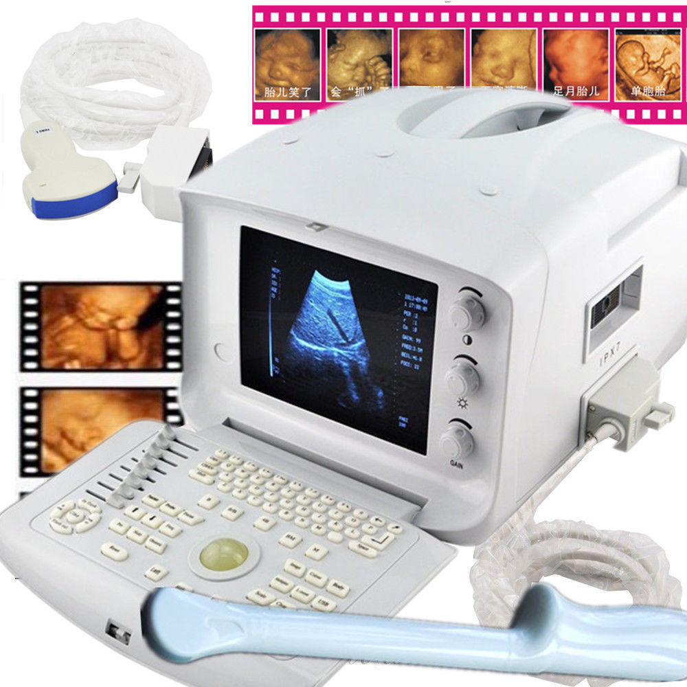 Free 3D Ultrasound Scanner Machine Convex Abdomen &Transvaginal Gynecology Probe 190891464798 DIAGNOSTIC ULTRASOUND MACHINES FOR SALE