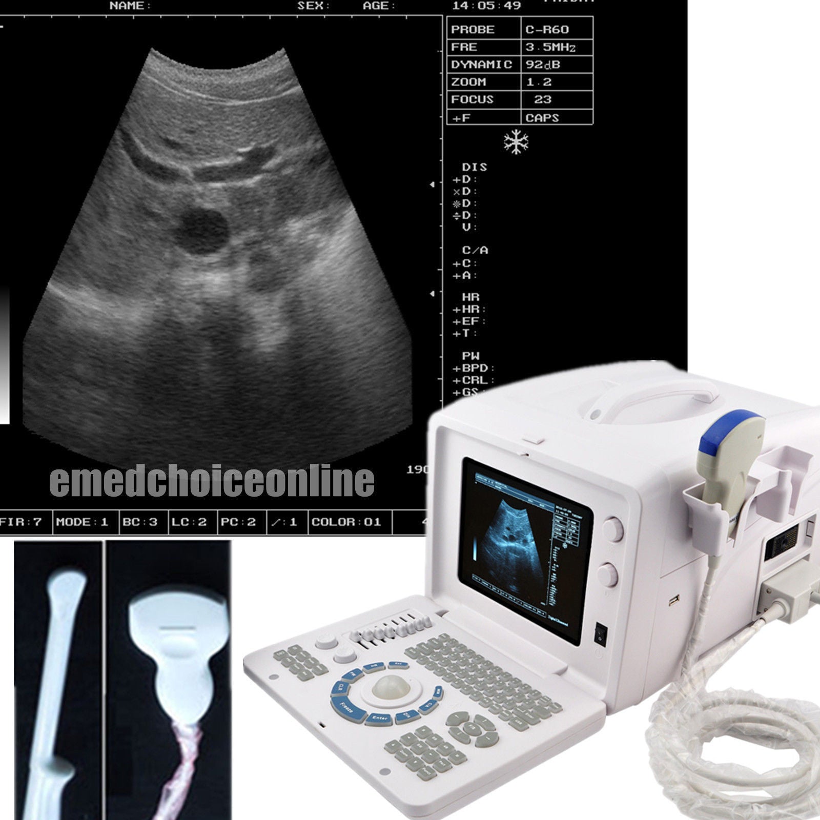 Top Digital Portable Ultrasound Scanner Device + Convex +Transvaginal Probes+ 3D DIAGNOSTIC ULTRASOUND MACHINES FOR SALE