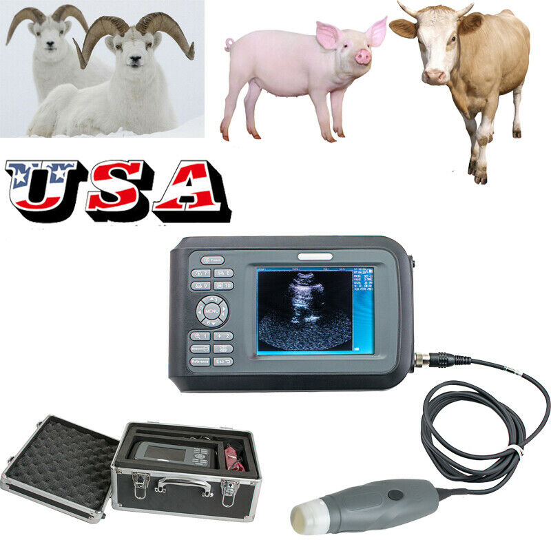 Portable Diagnostic Ultrasound Machine ultrasound Scanner System Convex Probe US DIAGNOSTIC ULTRASOUND MACHINES FOR SALE