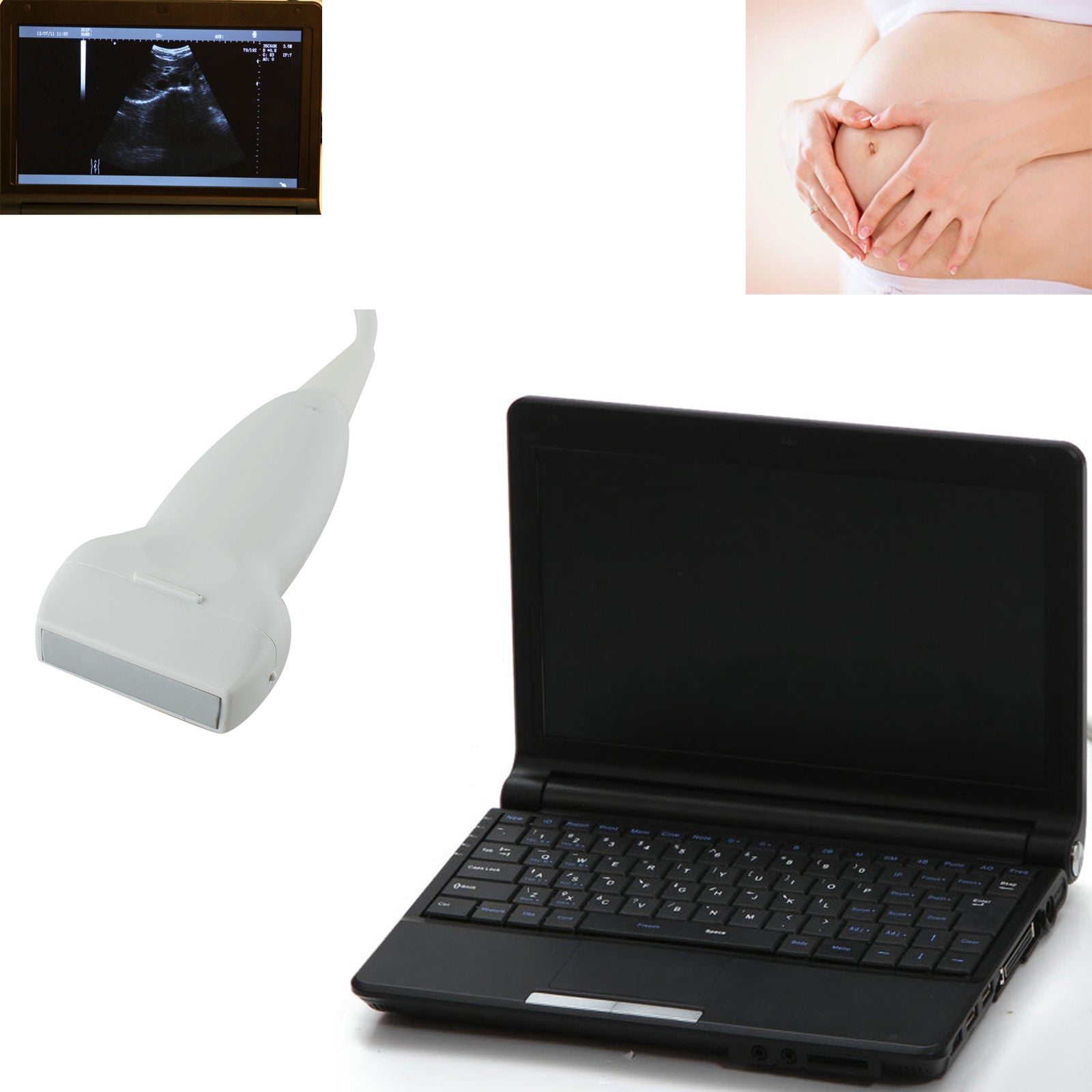 External 3D Digital Laptop Ultrasound Scanner With 7.5MHz Linear Probe 10"LCD CE DIAGNOSTIC ULTRASOUND MACHINES FOR SALE