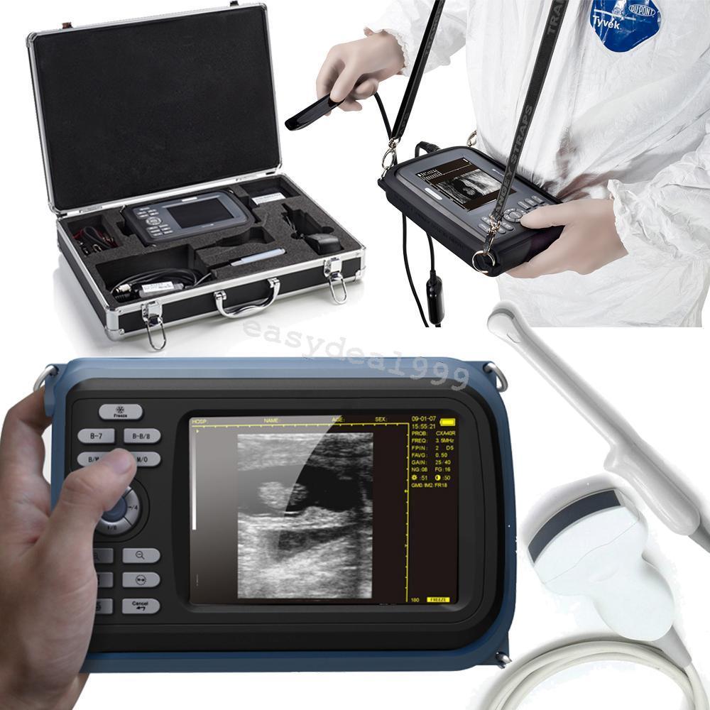 Handheld Digital Ultrasound Scanner Machine Convex Transvaginal 2 Probes Battery 190891393951 DIAGNOSTIC ULTRASOUND MACHINES FOR SALE