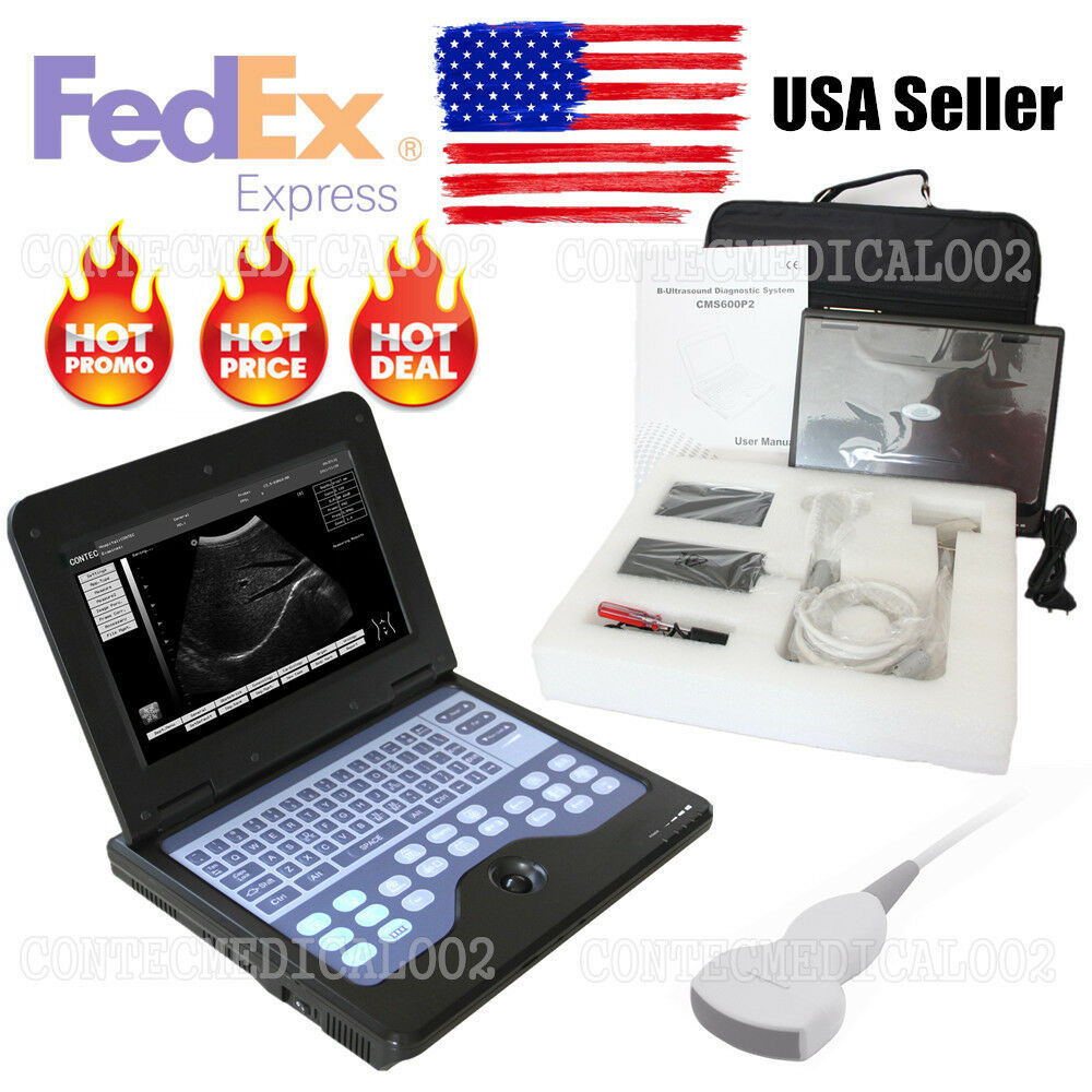 Portable laptop machine Digital Ultrasound scanner, Free 3.5Mhz Convex probe,USA 6945040100362 DIAGNOSTIC ULTRASOUND MACHINES FOR SALE