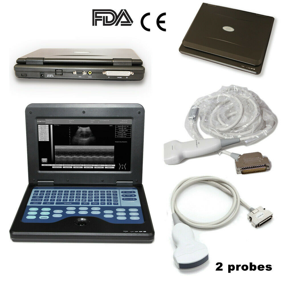 CE Portable Laptop Machine Digital Ultrasound Scanner+ Linear+ Convex 2 Probes 6945040100676 DIAGNOSTIC ULTRASOUND MACHINES FOR SALE