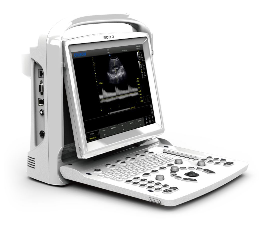 Chison ECO3, MSK, Tendon, Vascular Black/White Ultrasound Machine & Linear Probe DIAGNOSTIC ULTRASOUND MACHINES FOR SALE