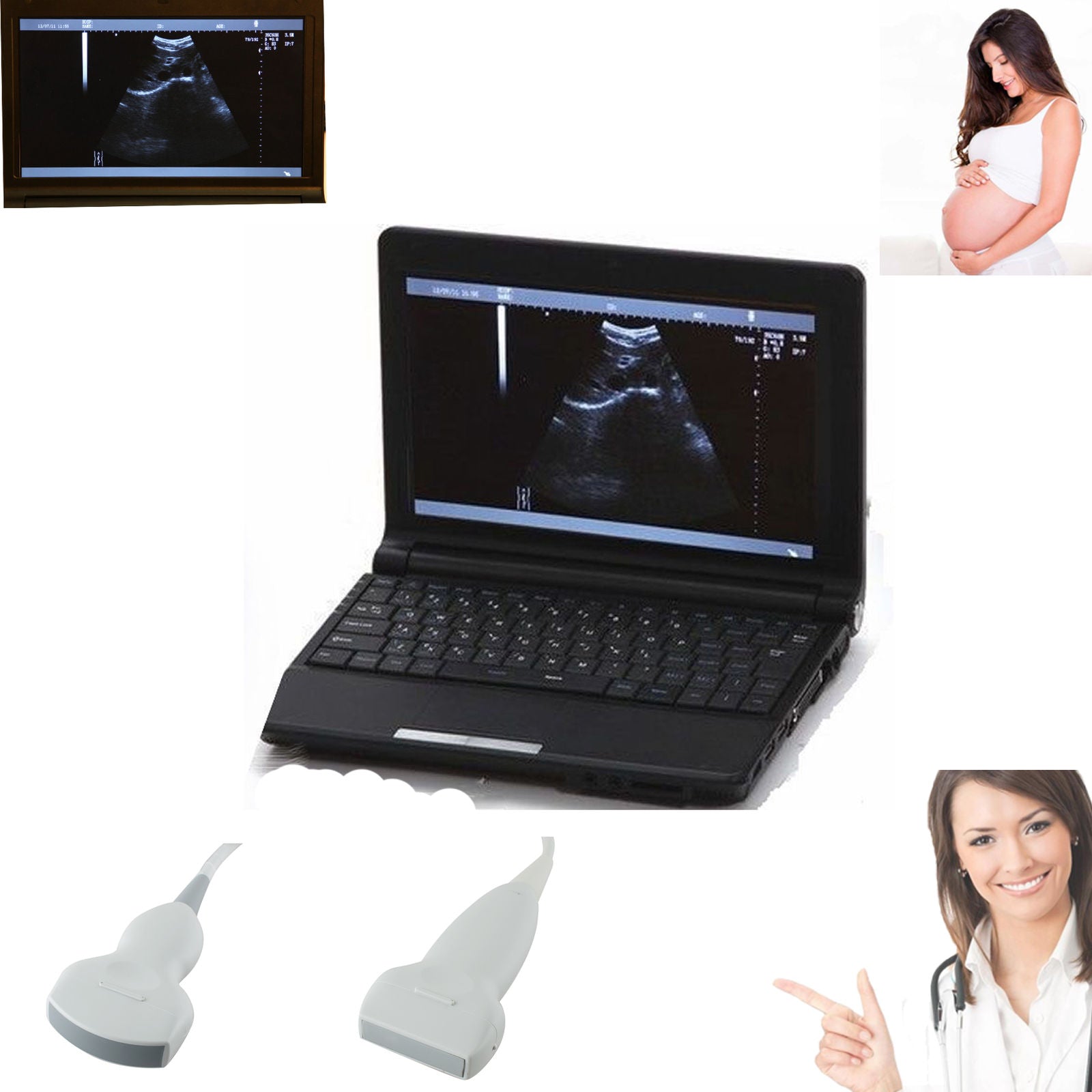 Digital Laptop External 3D Ultrasound  Scanner+ Convex & Linear Probe 10" LCD CE 190891750662 DIAGNOSTIC ULTRASOUND MACHINES FOR SALE