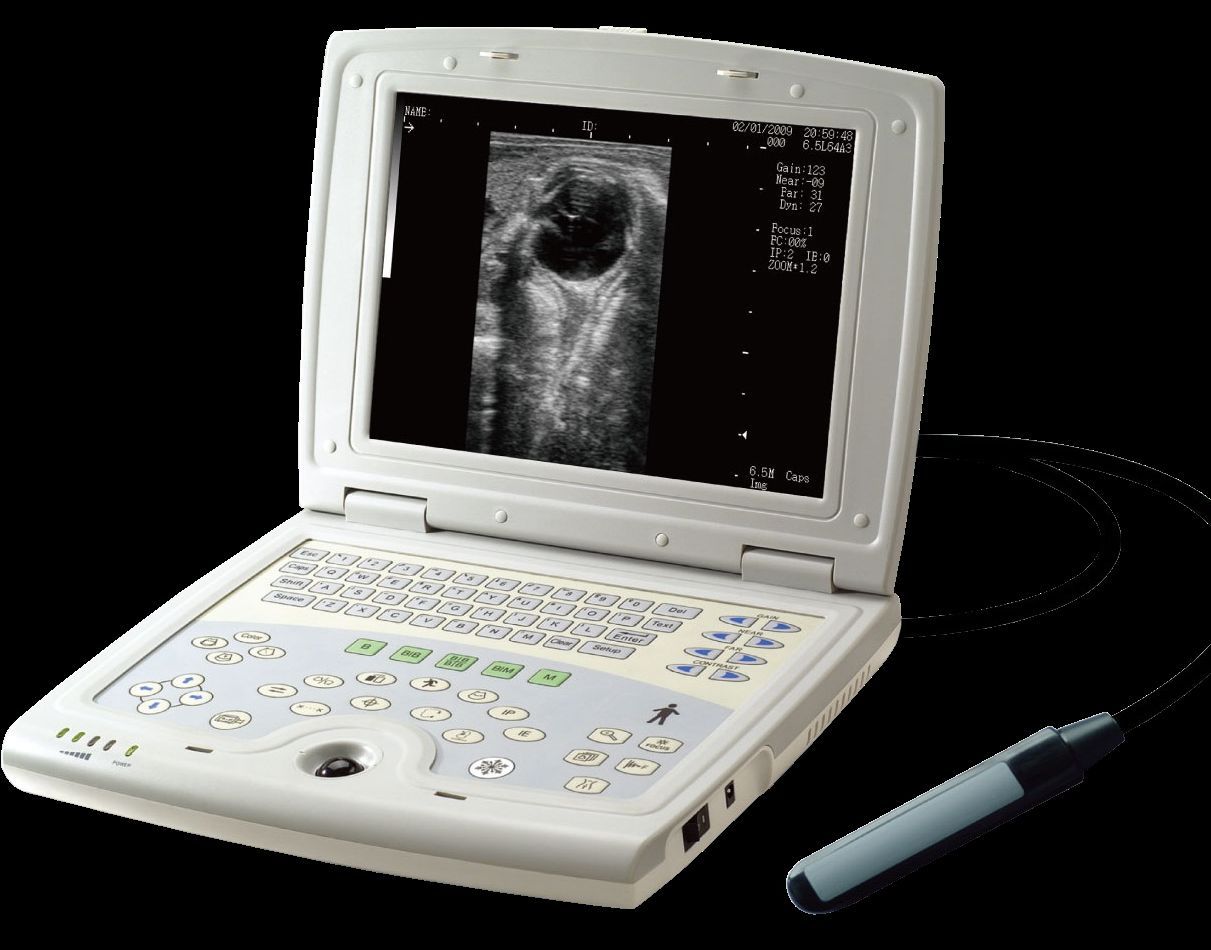 KX5000V Veterinary Laptop Ultrasound, Large Animal, Bovine, Horse | KeeboMed DIAGNOSTIC ULTRASOUND MACHINES FOR SALE