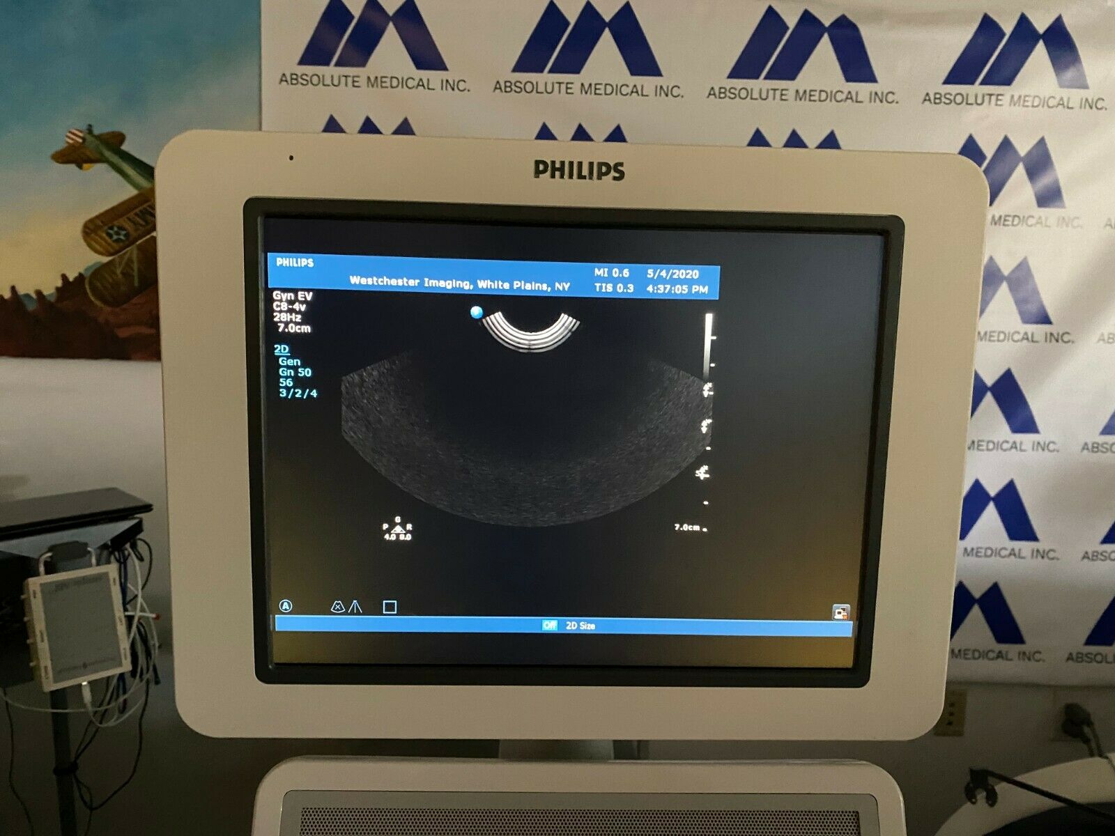 PHILLIPS HD-15 Ultrasound Machine DIAGNOSTIC ULTRASOUND MACHINES FOR SALE