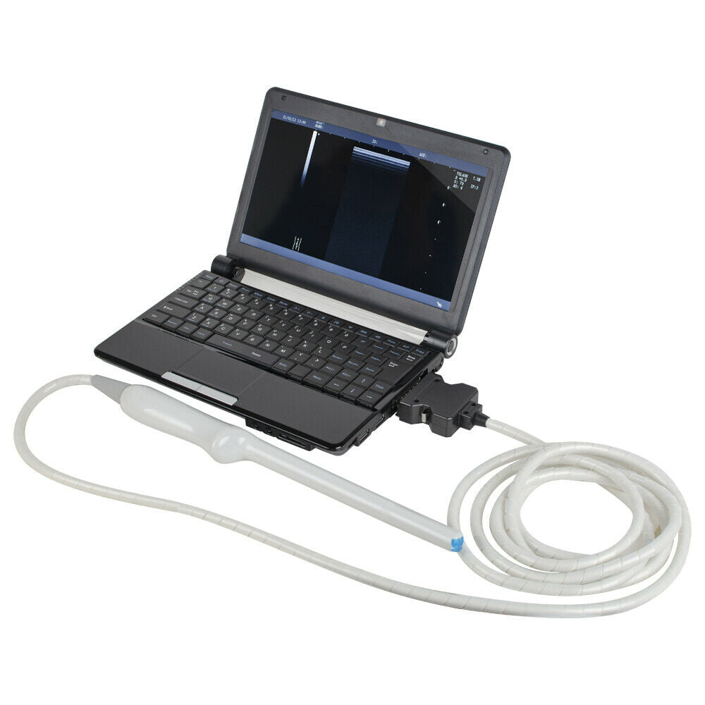 10" Portable Laptop Ultrasound Scanner Machine System Linear Transvaginal Probe DIAGNOSTIC ULTRASOUND MACHINES FOR SALE