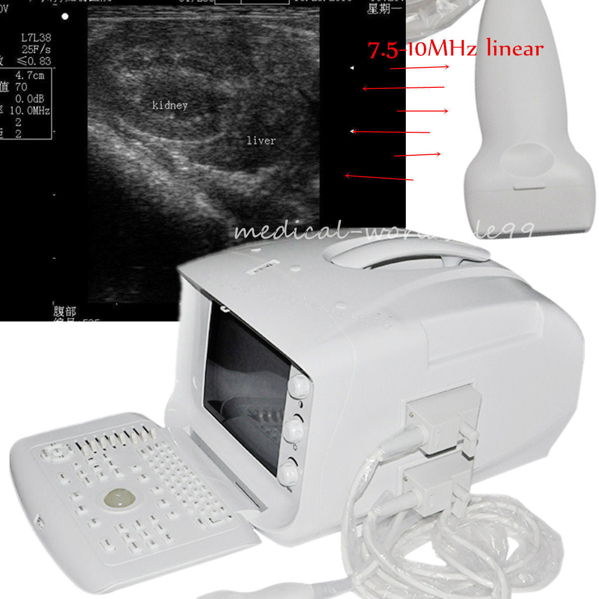 Full Digital Ultrasonic Ultrasound Scanner/Machine Linear High Frequency Probes DIAGNOSTIC ULTRASOUND MACHINES FOR SALE