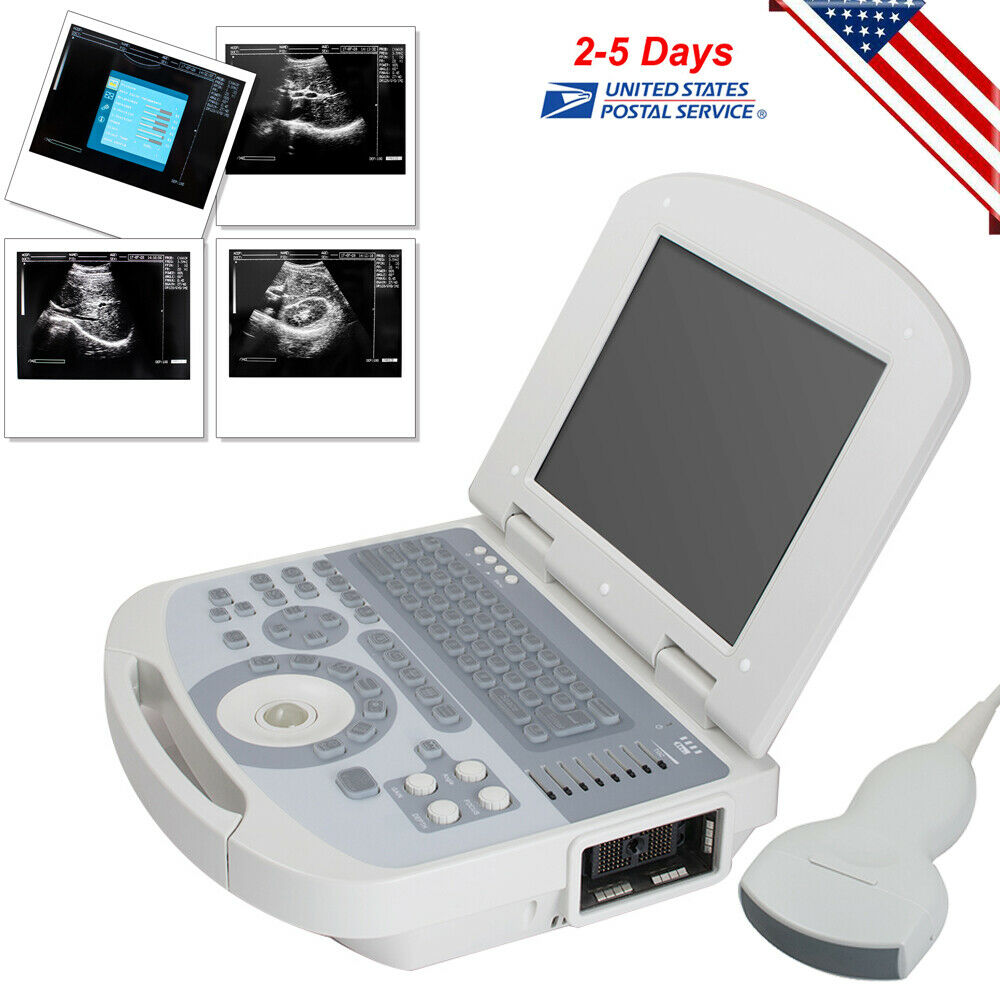 Portable Digital Ultrasound Scanner Medical Machine System 3.5MHZ Convex Probe DIAGNOSTIC ULTRASOUND MACHINES FOR SALE