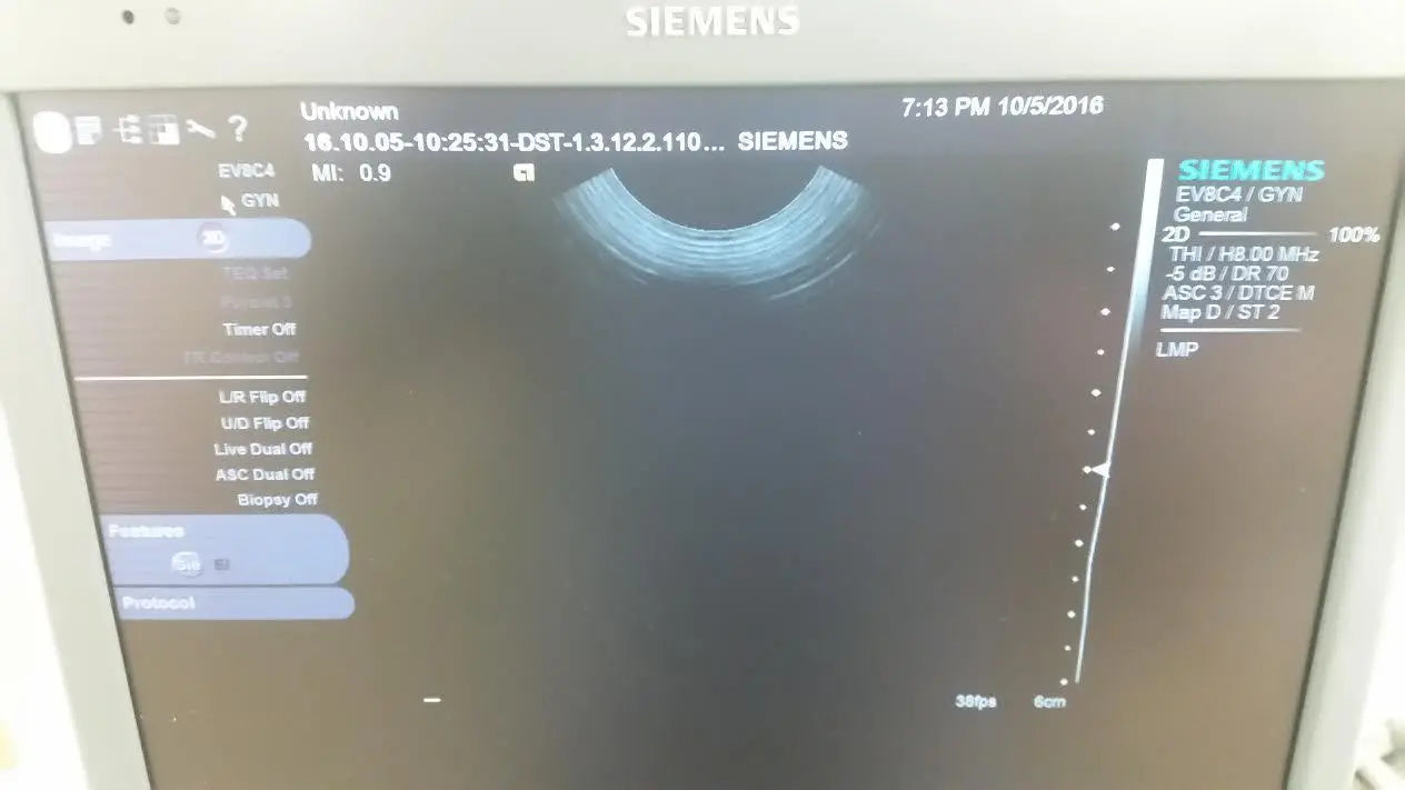 Siemens S2000 Ultrasound Machine with 4C1 and EV-8c4 Transducer Probes DIAGNOSTIC ULTRASOUND MACHINES FOR SALE