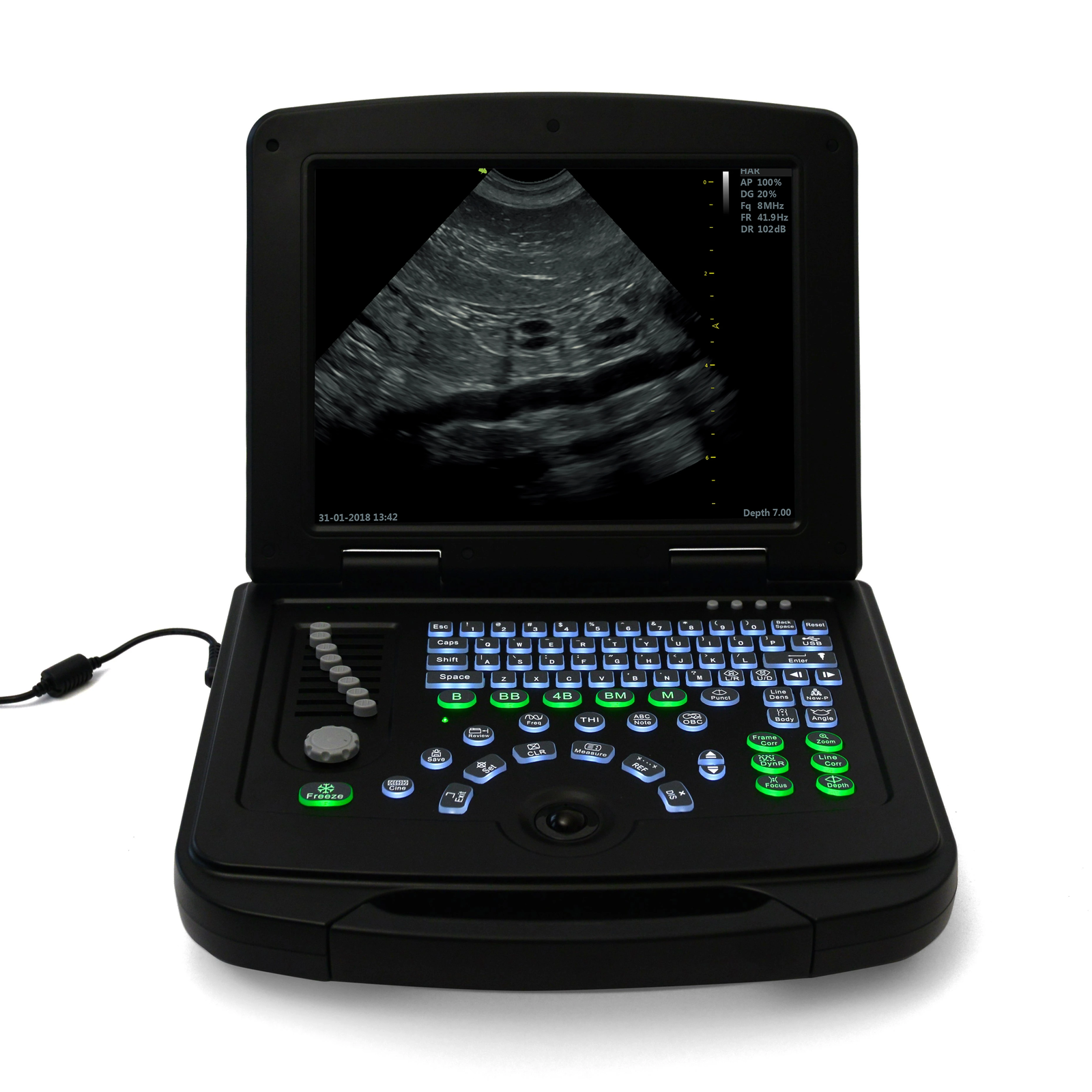 SmartBook™ Veterinary Grade 4K Portable Ultrasound Scanner Laptop for Dog & Cat DIAGNOSTIC ULTRASOUND MACHINES FOR SALE