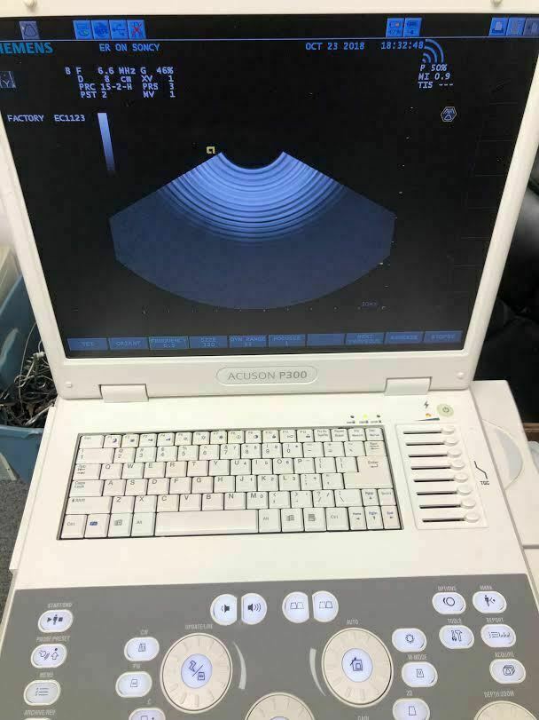 Siemens Acuson P300 Portable Ultrasound Machine (probes available as well) DIAGNOSTIC ULTRASOUND MACHINES FOR SALE