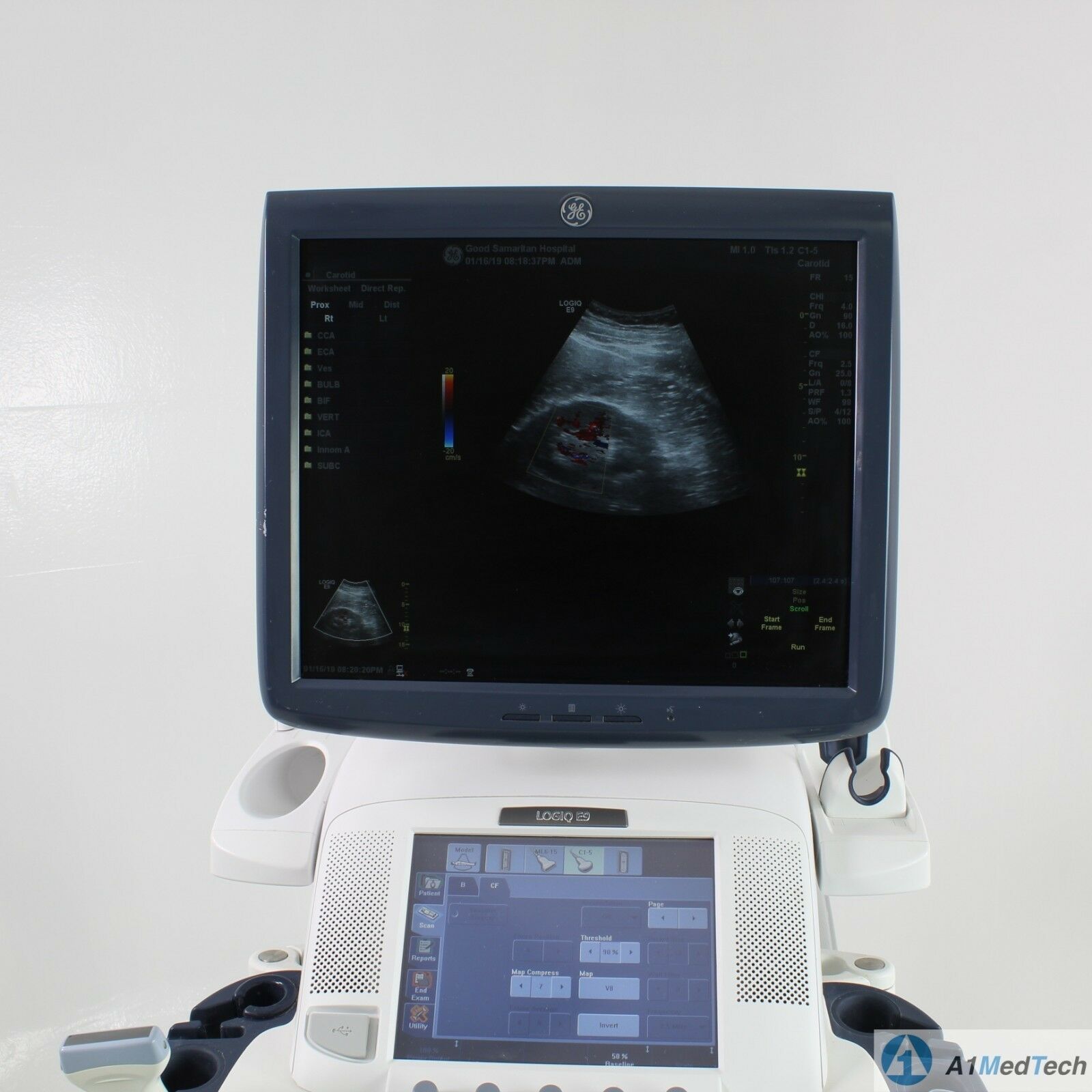 GE Logiq E9 Ultrasound System with C1-5-D & ML6-15-D  Probes DIAGNOSTIC ULTRASOUND MACHINES FOR SALE