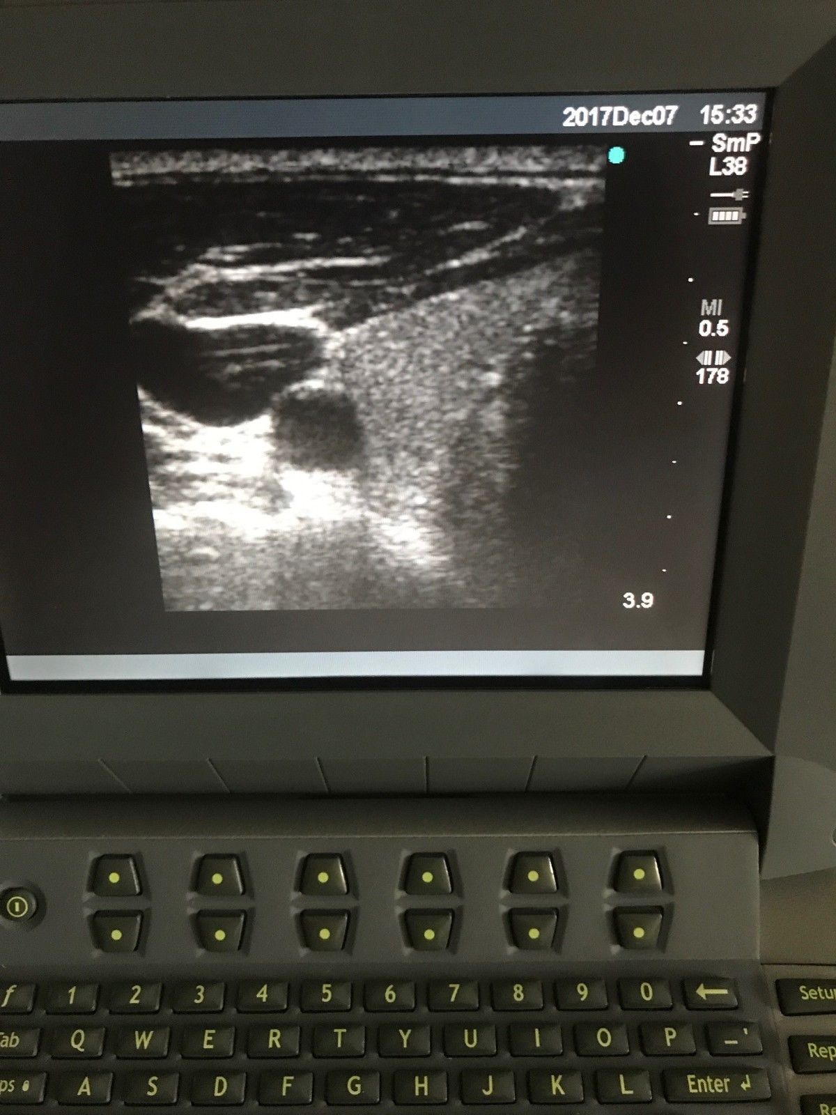 SonoSite Titan Portable Ultrasound Tested with Probe, Charger & New OEM Battery DIAGNOSTIC ULTRASOUND MACHINES FOR SALE