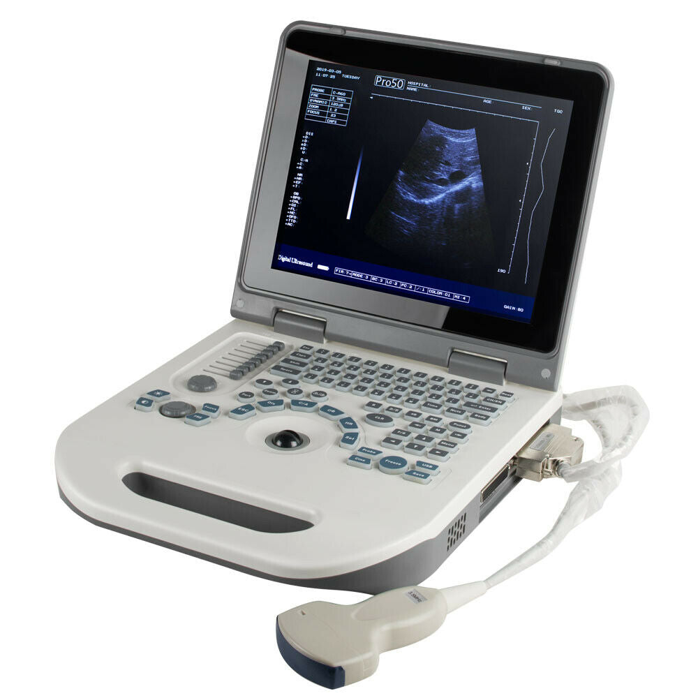 Notebook Digital Laptop Ultrasound Scanner Diagnostic System 3.5MHz Convex+3D DIAGNOSTIC ULTRASOUND MACHINES FOR SALE