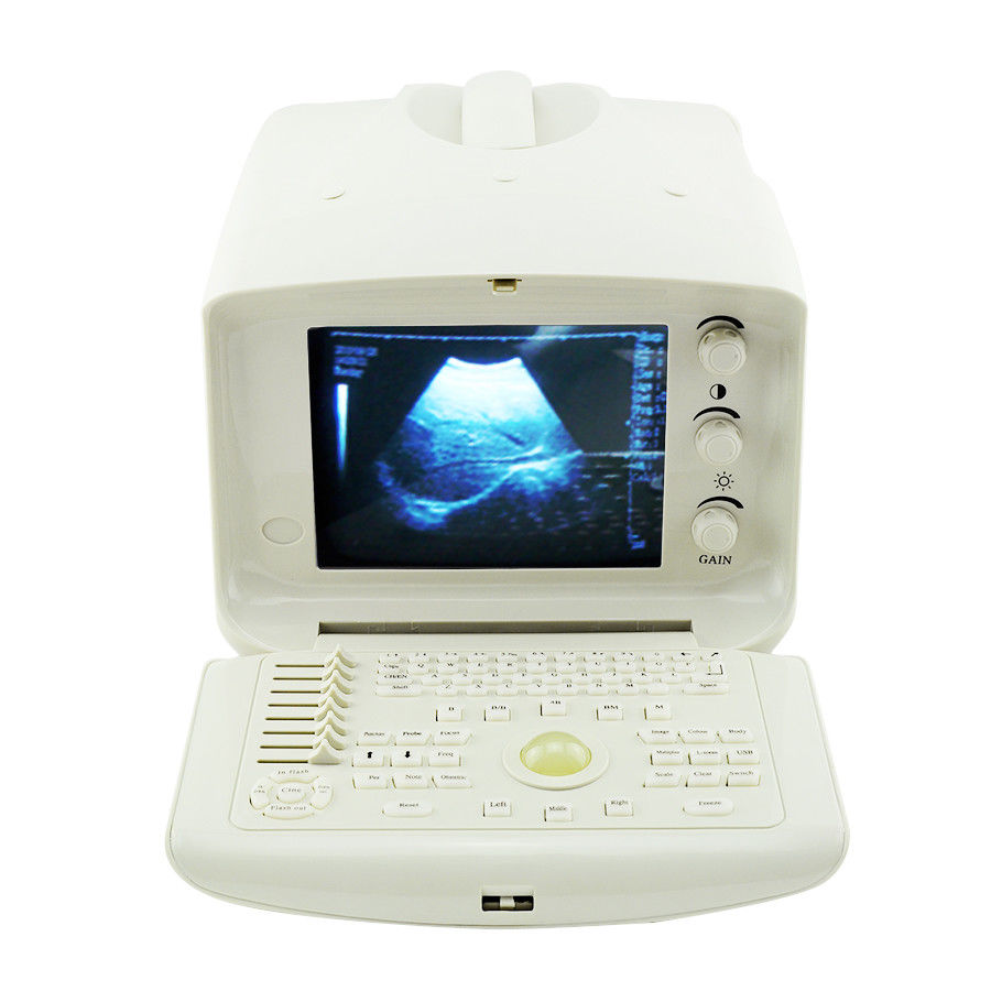 Ultrasound Scanner Portable Monitor Machine 7.5MHz Linear Probe Gift 3D Image CE 190891468420 DIAGNOSTIC ULTRASOUND MACHINES FOR SALE