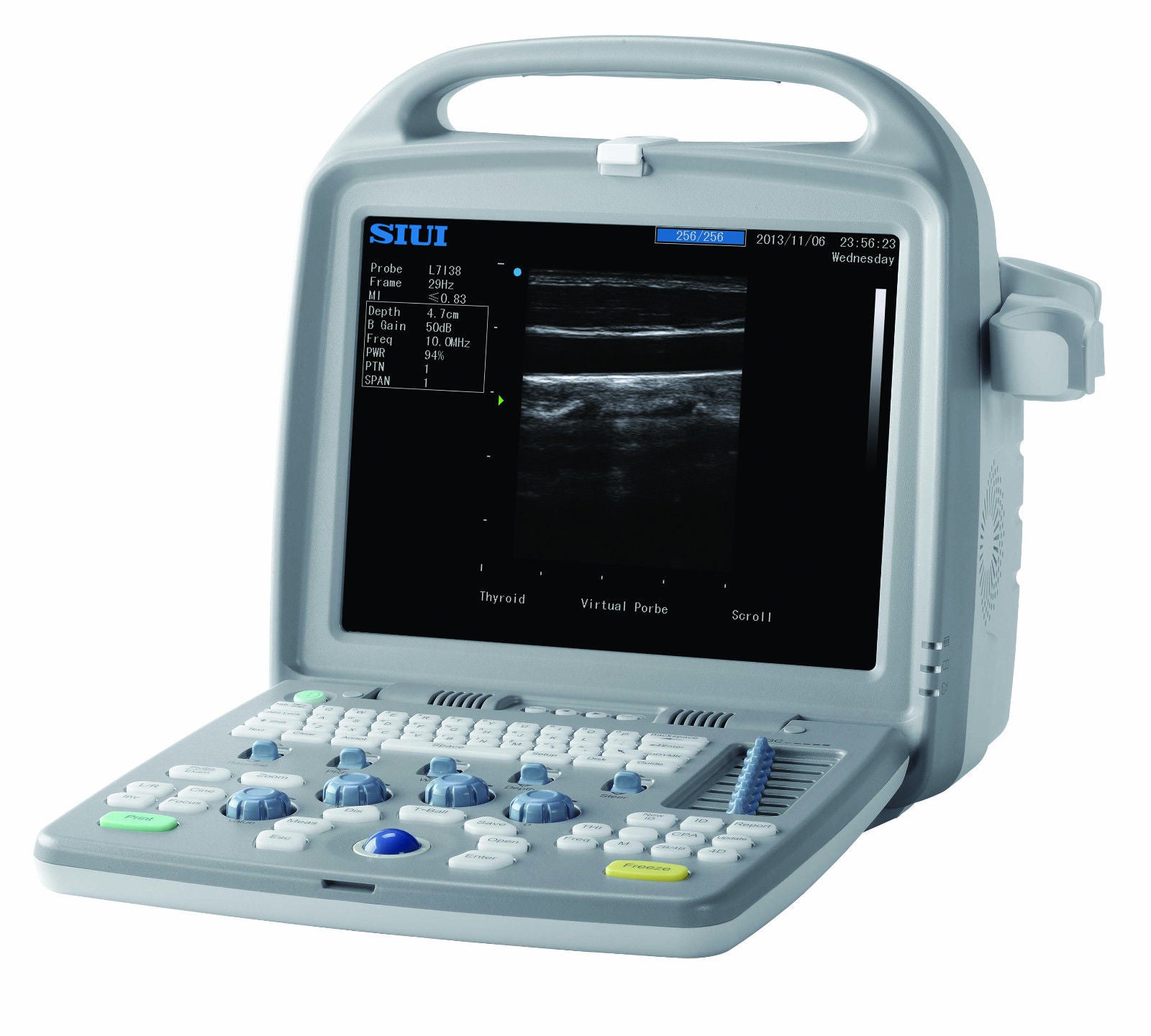 SIUI - 5500 Plus Ultrasound with Convex or Linear Probe DIAGNOSTIC ULTRASOUND MACHINES FOR SALE