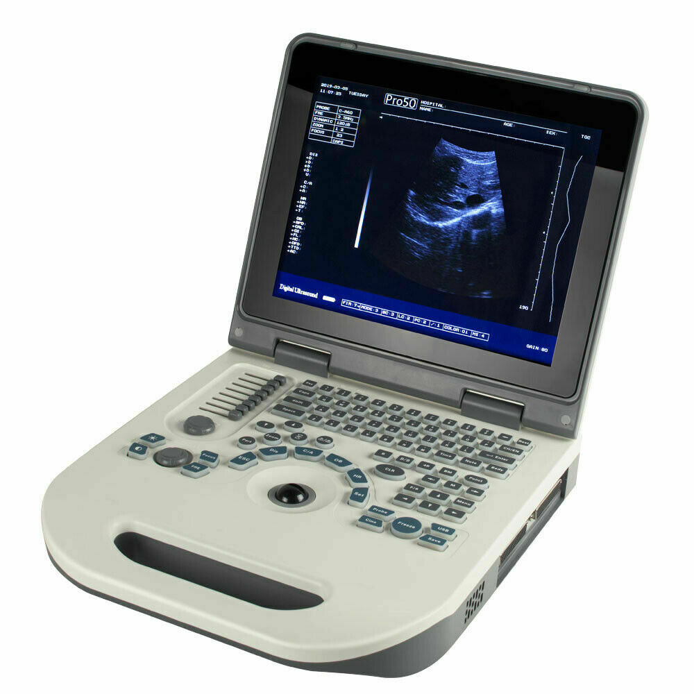 U 3.5Mhz Notebook Full Digital Ultrasound Scanner Diagnostic System Convex Probe DIAGNOSTIC ULTRASOUND MACHINES FOR SALE