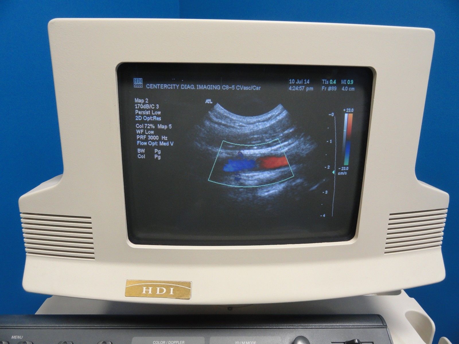 ATL C8-5 14R Micro-Convex Pediatric Small Parts Vascular MSK OB  Probe (6865) DIAGNOSTIC ULTRASOUND MACHINES FOR SALE