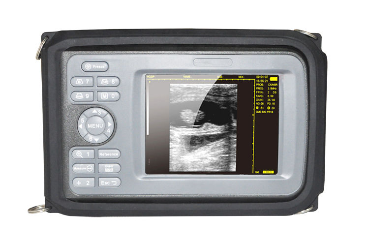 CE Handheld Smartscan Ultrasound Scanner Systerm,Convex Probe + ECG /EKG Machine DIAGNOSTIC ULTRASOUND MACHINES FOR SALE