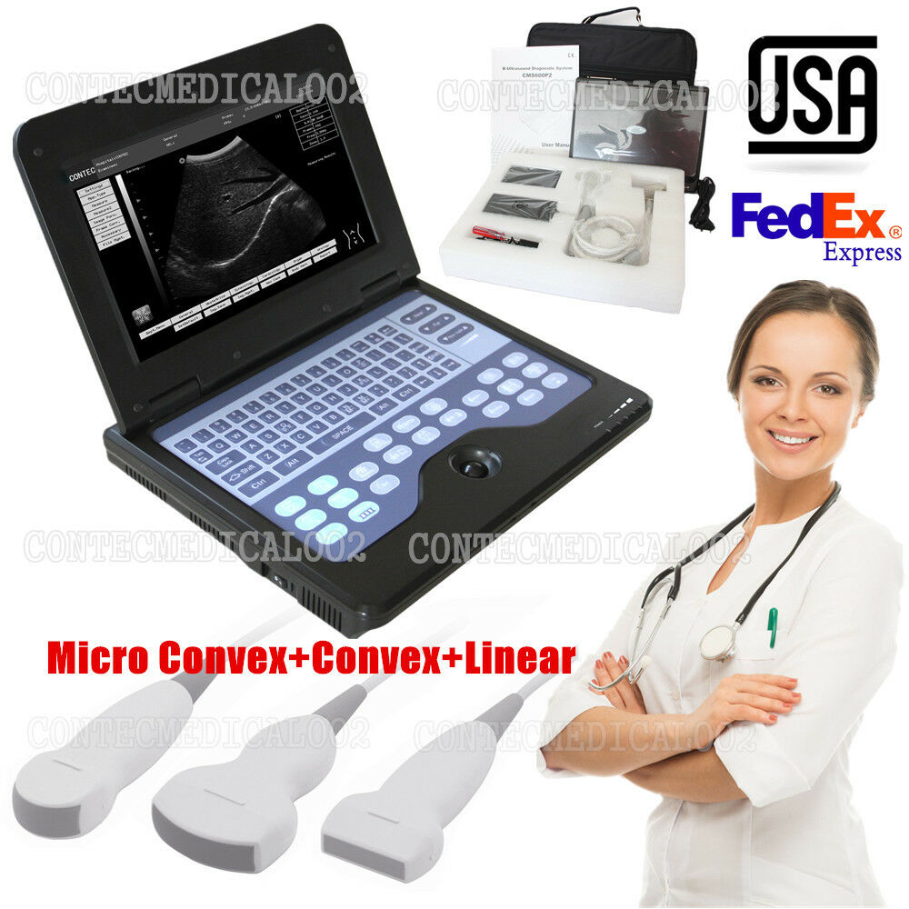 USA Portable ultrasound scanner laptop machine 3 Probes Convex  Linear Cardiac DIAGNOSTIC ULTRASOUND MACHINES FOR SALE