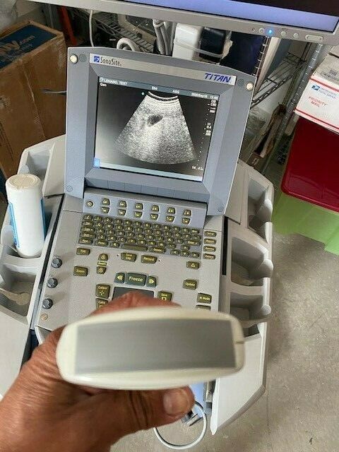 2008 Sonosite Titan Ultrasound system with Docking cart 19" Monitor DIAGNOSTIC ULTRASOUND MACHINES FOR SALE