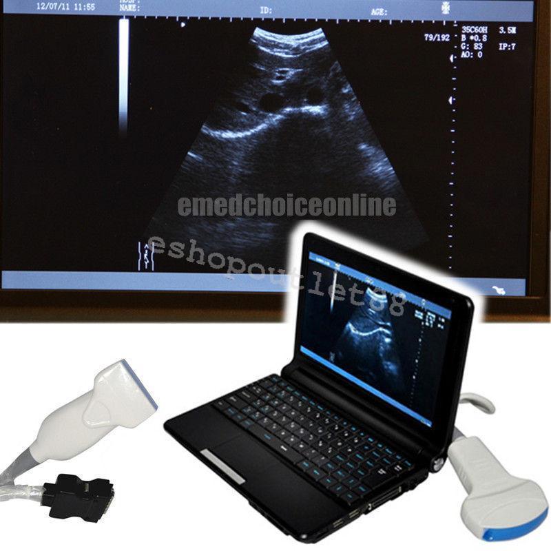 CE Full Digital Laptop Ultrasound Scanner with Linear probe +Free 3D 9000F Model DIAGNOSTIC ULTRASOUND MACHINES FOR SALE