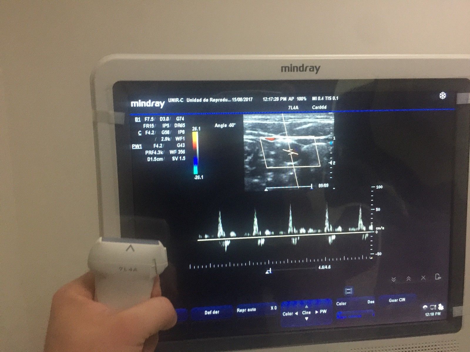 MINDRAY 7L4A LINEAR PROBE FOR DC-3 AND DC-N3 DIAGNOSTIC ULTRASOUND MACHINES FOR SALE